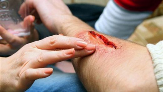 Enfeksiyon Riski Belirtileri ve Tedavisi