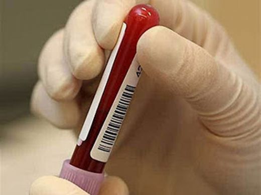 Kandaki Enfeksiyon Nasıl Geçer?